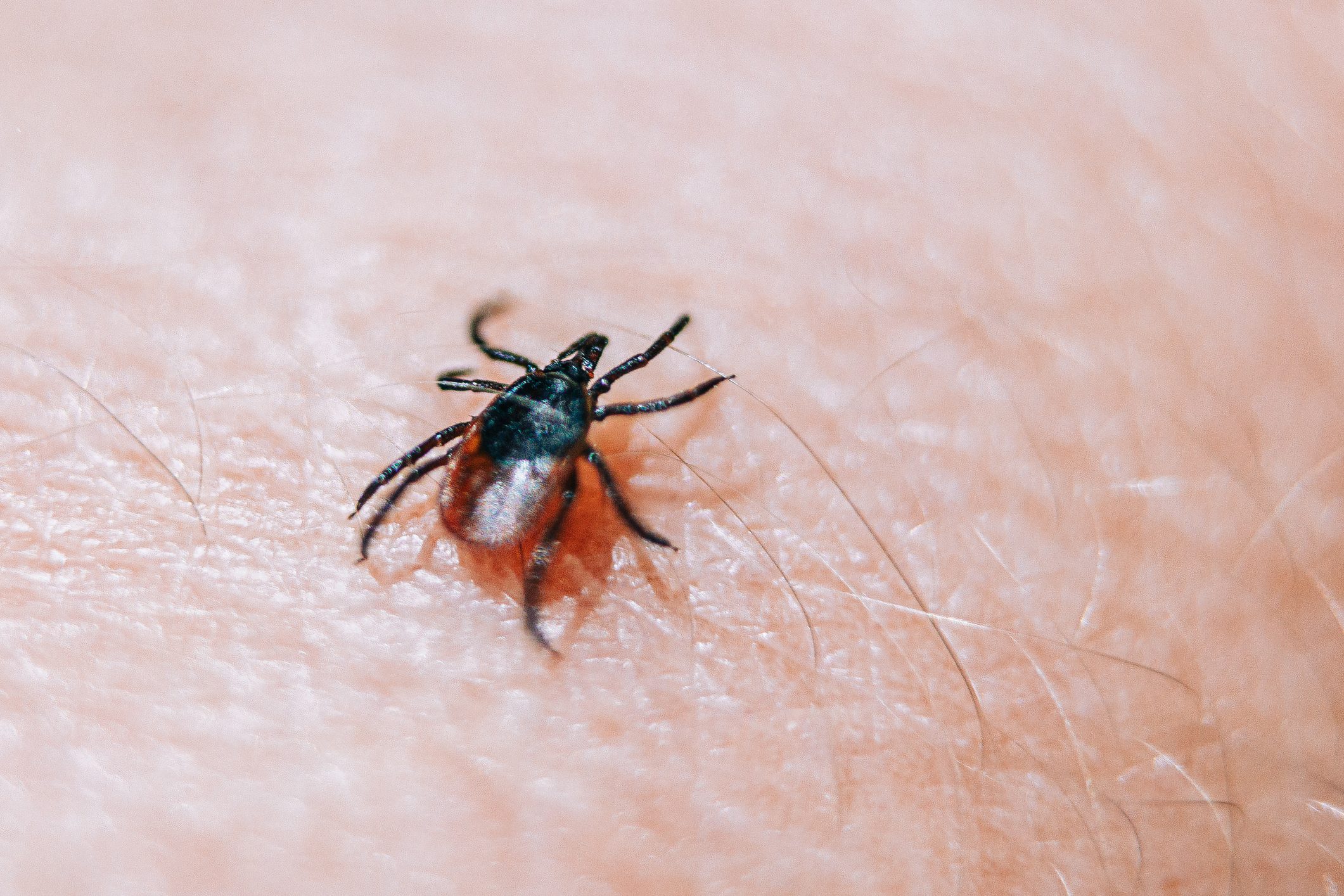 Dangerous deer tick crawling on human skin